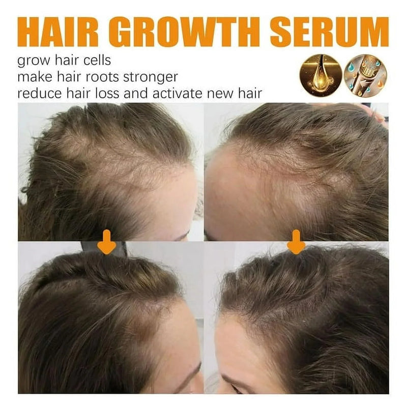 Biotin Hair Growth Spray, Biotin Hair Growth Serum, Biotin Thickening Herbal Serum, anti Hair Loss Serum for Women Men Hair Growth and Hair Loss - Puck's