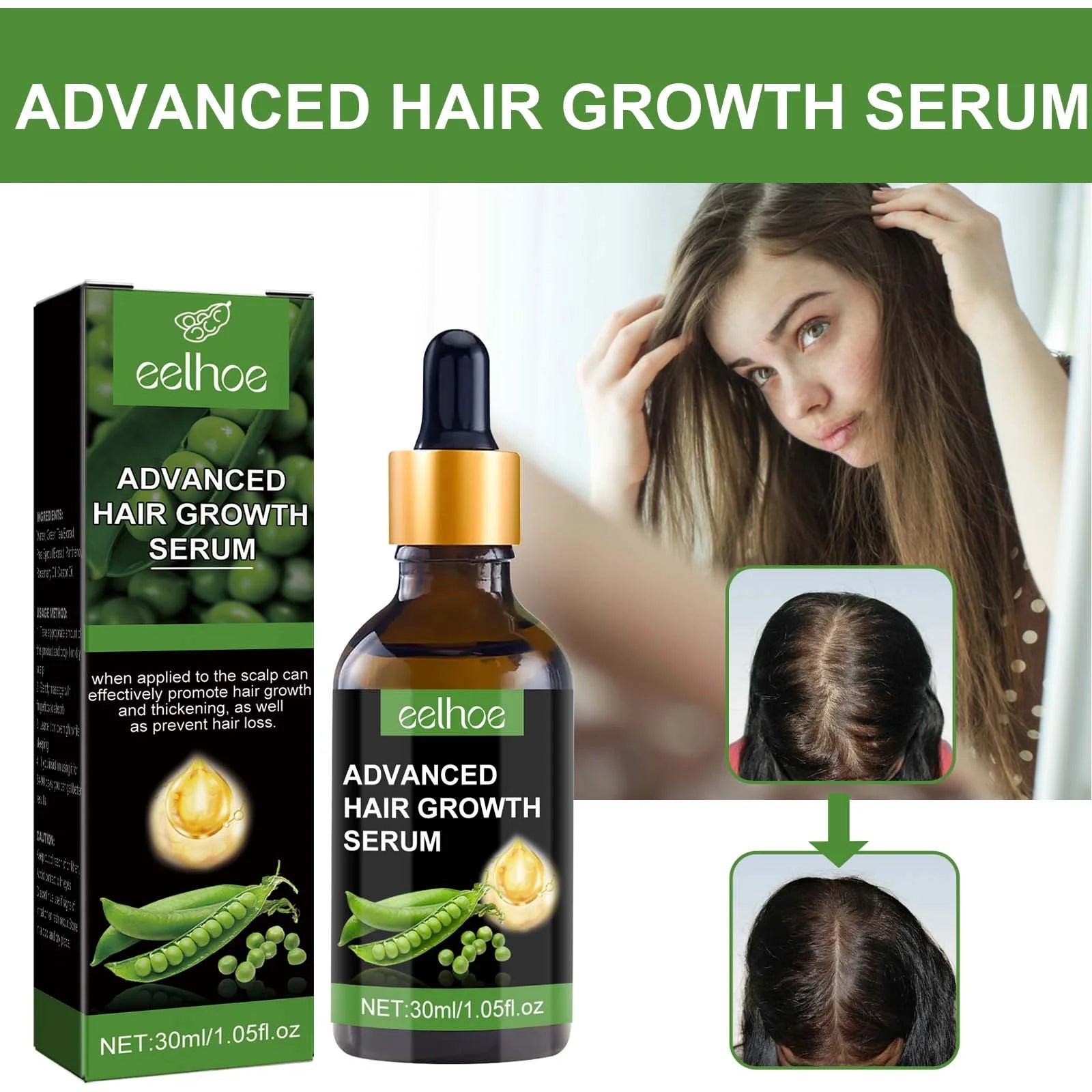 Biotin Hair Growth Serum,Advanced Hair Growth Serum,Hair Growth Serum Promotes Hair Growth, Moisturizes, Strengthens Hair and Nourishes the Scalp for Both Men and Women 30Ml - Puck's