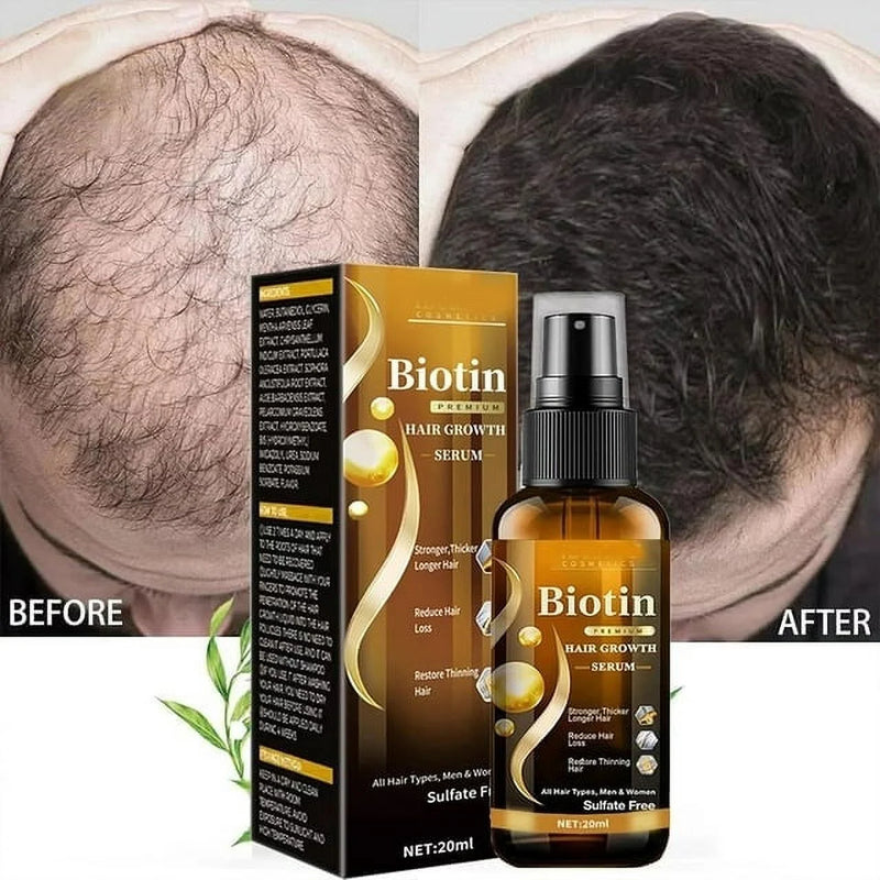 Biotin Hair Growth Spray, Biotin Hair Growth Serum, Biotin Thickening Herbal Serum, anti Hair Loss Serum for Women Men Hair Growth and Hair Loss - Puck's