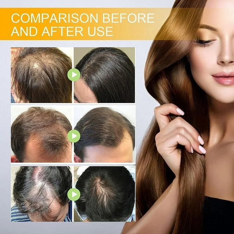 Biotin Hair Growth Spray, Biotin Hair Growth Serum, Biotin Thickening Herbal Serum, anti Hair Loss Serum for Women Men Hair Growth and Hair Loss - Puck's