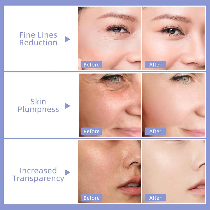 The Dewy Moisturizer Cream Anti-Aging Face Moisturizer Dewy Skin Cream for Women with Purple Rice & Hyaluronic Acid for Radiant, Hydrated Skin 50Ml/1.7 Fl Oz - Puck's