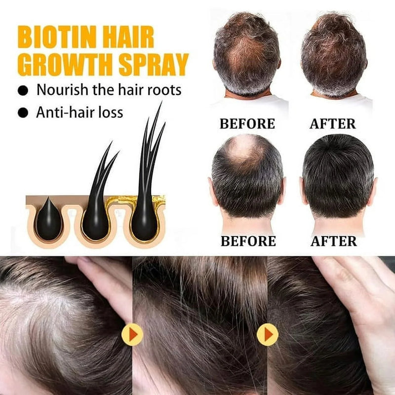 Biotin Hair Growth Spray, Biotin Hair Growth Serum, Biotin Thickening Herbal Serum, anti Hair Loss Serum for Women Men Hair Growth and Hair Loss - Puck's