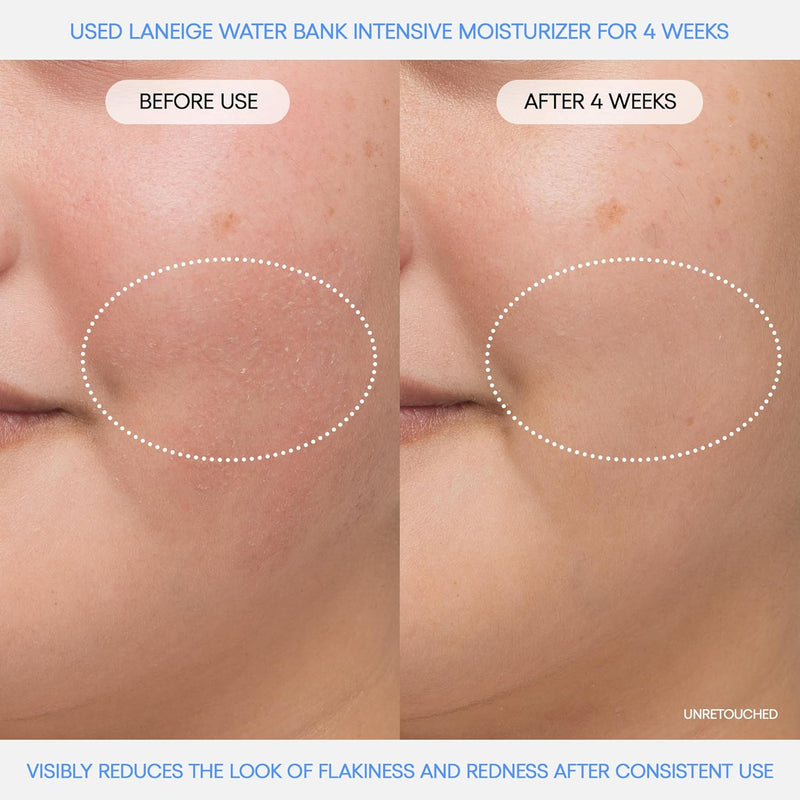 Water Bank Blue Hyaluronic Intensive Moisturizer with Peptides + Squalane: Eczema-Prone Skin, Barrier-Boosting, Nourish, Dryness - Puck's