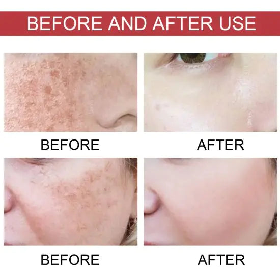Fade Skin Spots Moisturizing Care Solution - Puck's