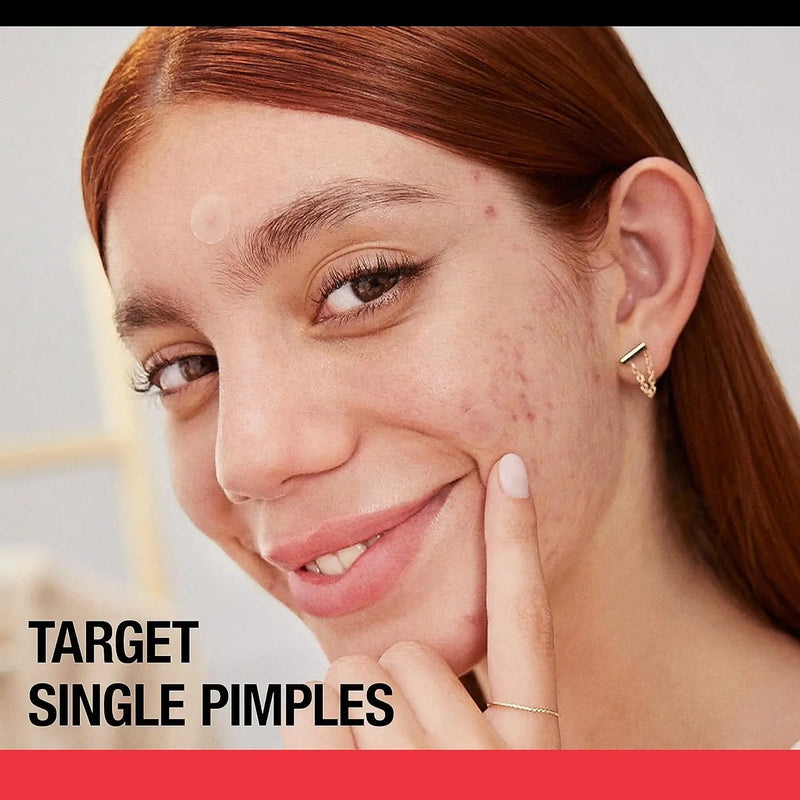 Stubborn Acne Pimple Patches, Acne Treatment for Face, Ultra-Thin Hydrocolloid Spot Stickers Provide Optimal Healing for Pimples, 24 Patches - Puck's