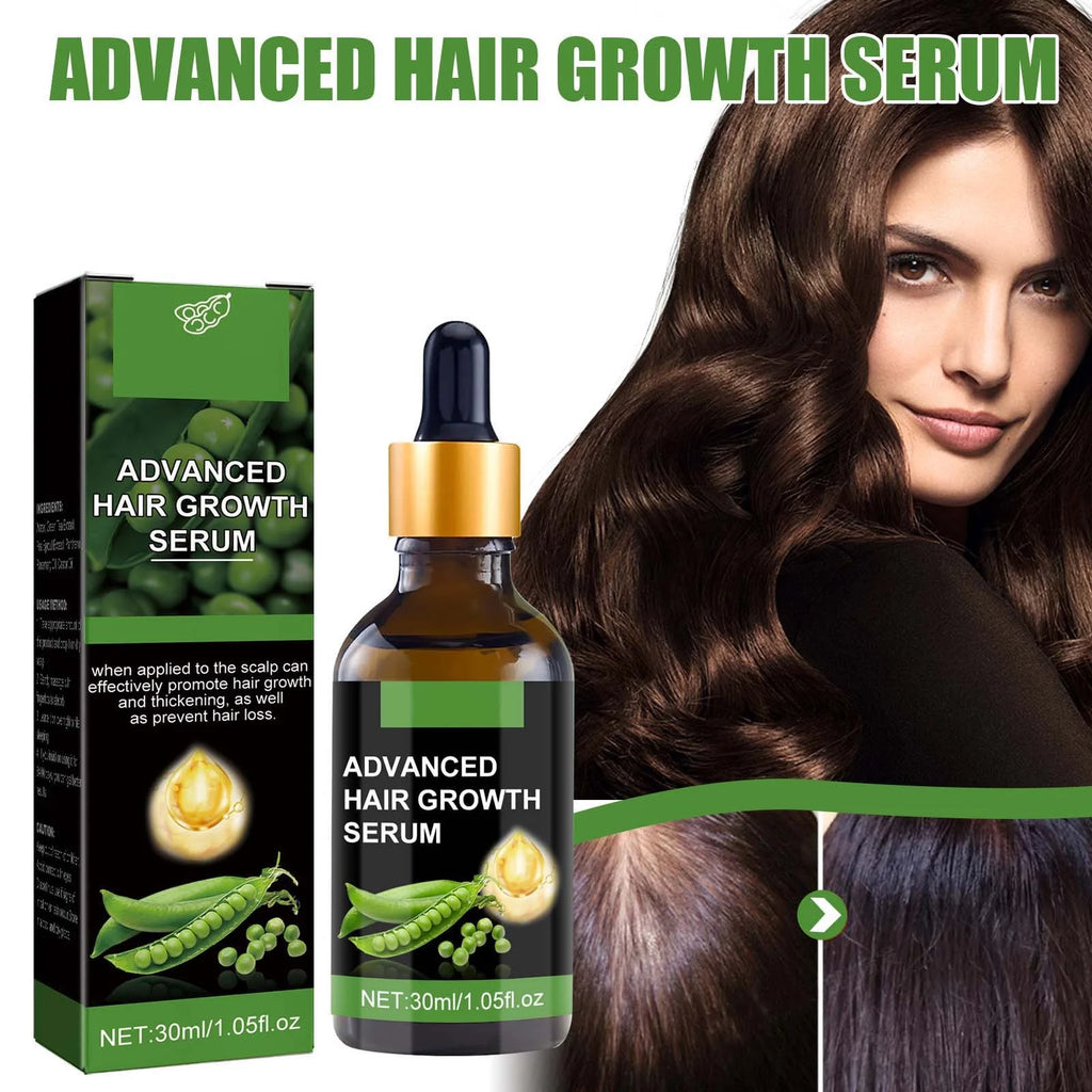 Biotin Hair Growth Serum,Advanced Hair Growth Serum,Hair Growth Serum Promotes Hair Growth, Moisturizes, Strengthens Hair and Nourishes the Scalp for Both Men and Women 30Ml - Puck's