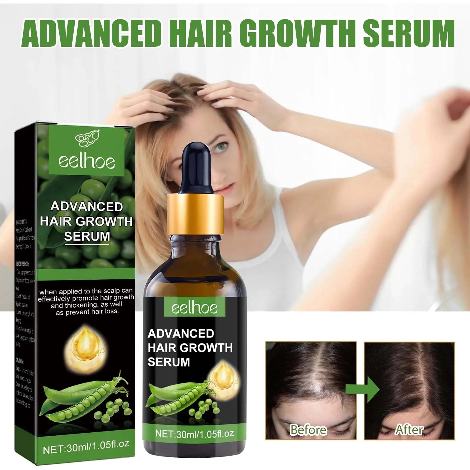 Biotin Hair Growth Serum,Advanced Hair Growth Serum,Hair Growth Serum Promotes Hair Growth, Moisturizes, Strengthens Hair and Nourishes the Scalp for Both Men and Women 30Ml - Puck's