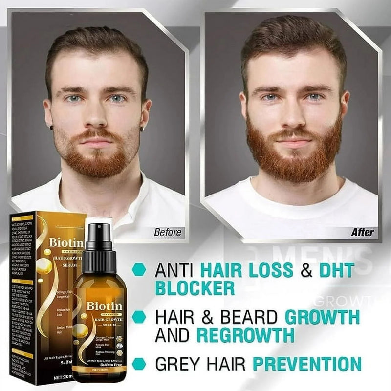 Biotin Hair Growth Spray, Biotin Hair Growth Serum, Biotin Thickening Herbal Serum, anti Hair Loss Serum for Women Men Hair Growth and Hair Loss - Puck's