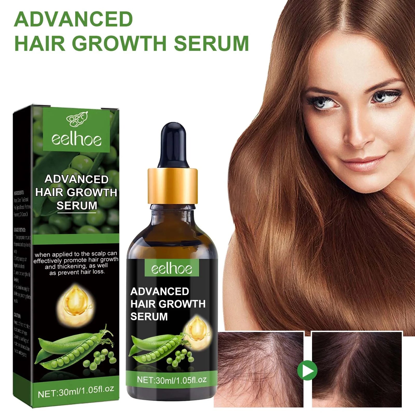 Biotin Hair Growth Serum,Advanced Hair Growth Serum,Hair Growth Serum Promotes Hair Growth, Moisturizes, Strengthens Hair and Nourishes the Scalp for Both Men and Women 30Ml - Puck's