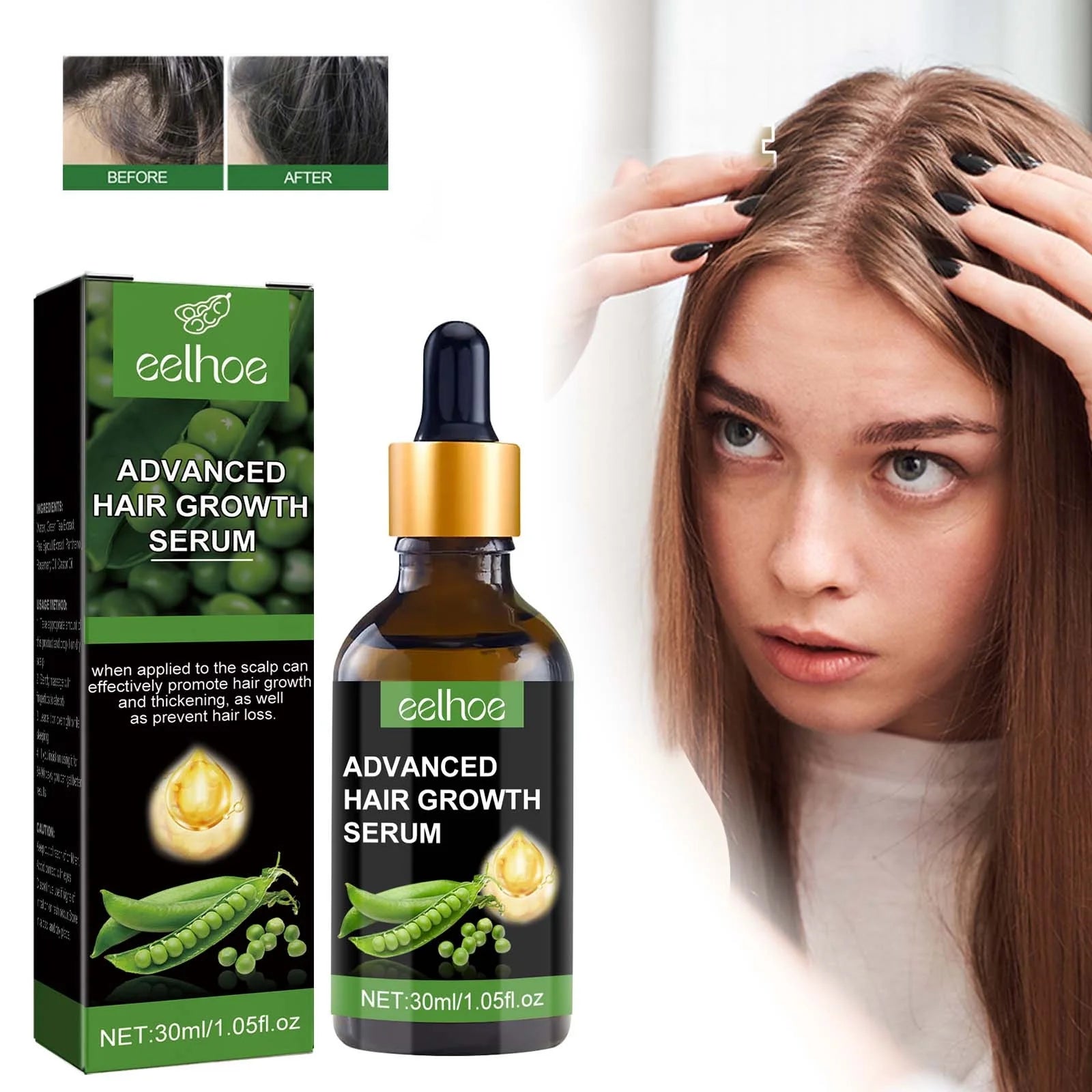 Biotin Hair Growth Serum,Advanced Hair Growth Serum,Hair Growth Serum Promotes Hair Growth, Moisturizes, Strengthens Hair and Nourishes the Scalp for Both Men and Women 30Ml - Puck's
